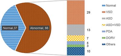 Classification of Children's Heart Sounds With Noise Reduction Based on Variational Modal Decomposition